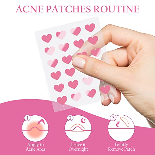Acne-Fighting Tea Tree Oil Before and After Photos - Image 4