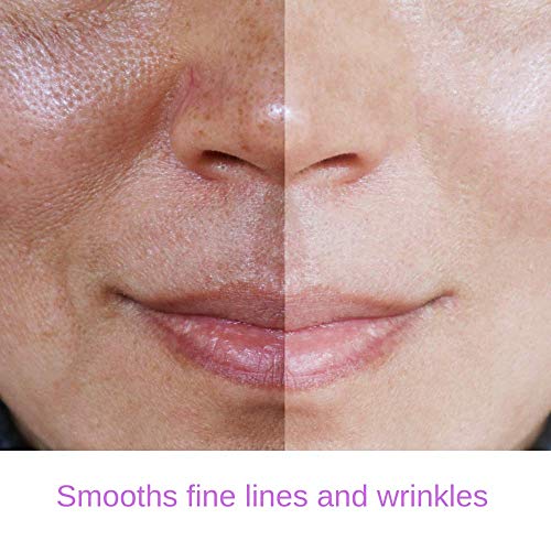 2.5% Retinol Serum with Hyaluronic Acid and Vitamin E, 30ml for Skin Care - Image 6