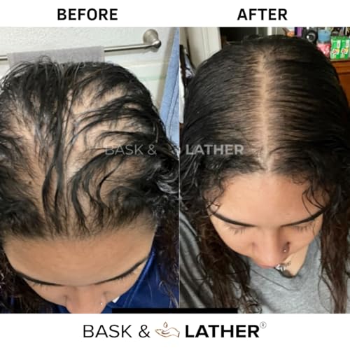 Bask & Lather Scalp Stimulator Hair Growth Oil, 4 Fl Oz for Healthy Hair - Image 2