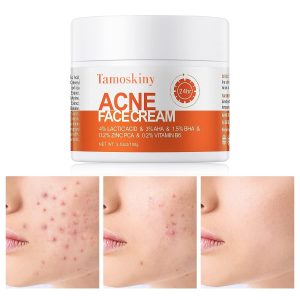 Acne Treatment Moisturizing Face Cream