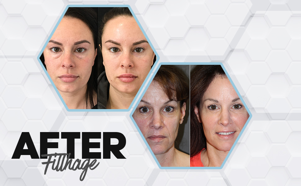  collagen for face, anti aging skin care sets for women